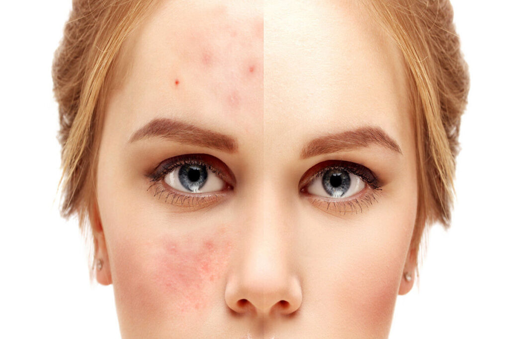 درمان خانگی