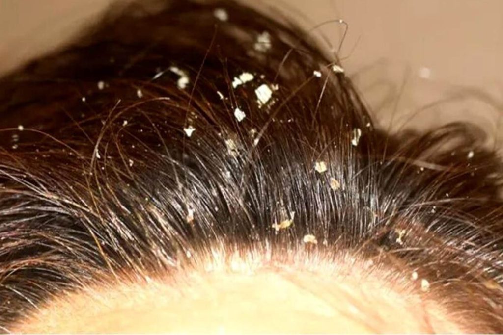 درمان خانگی