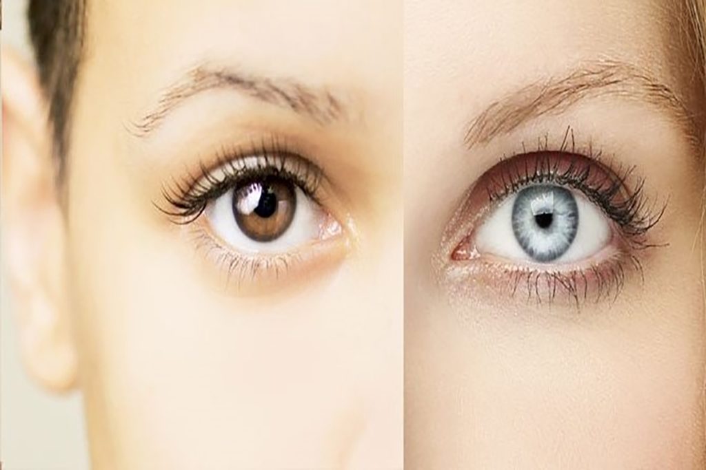 تغییر رنگ چشم