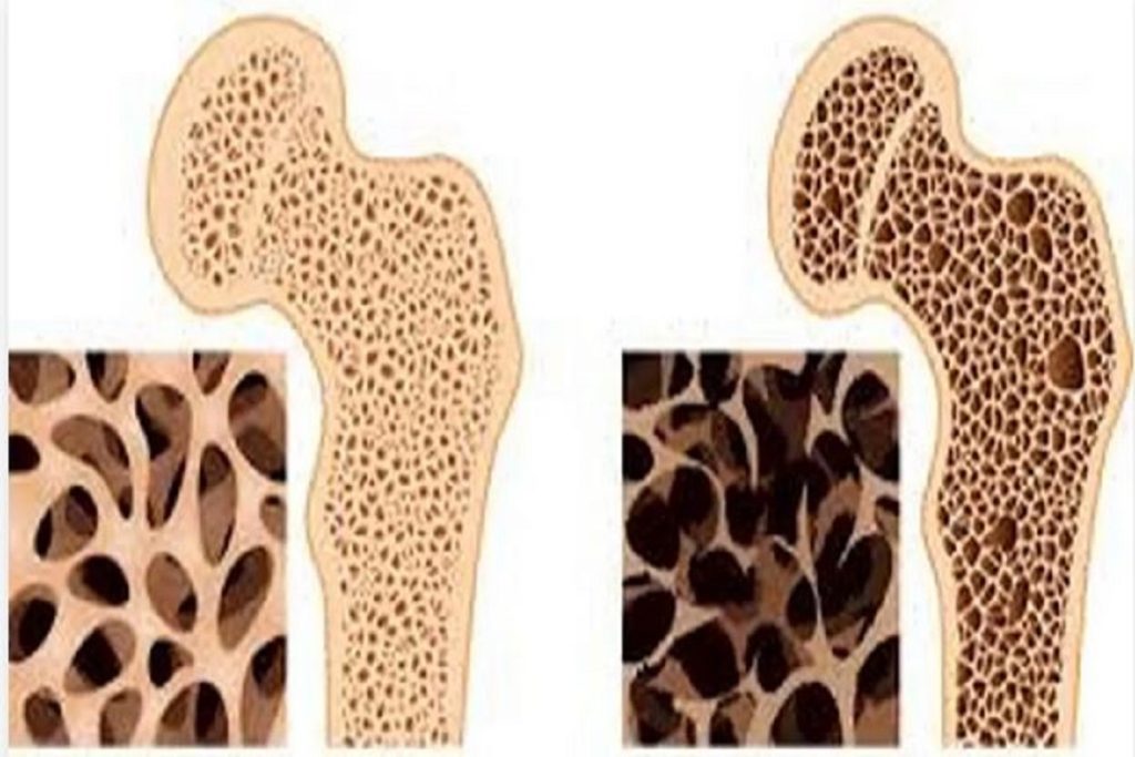 داروی گیاهی