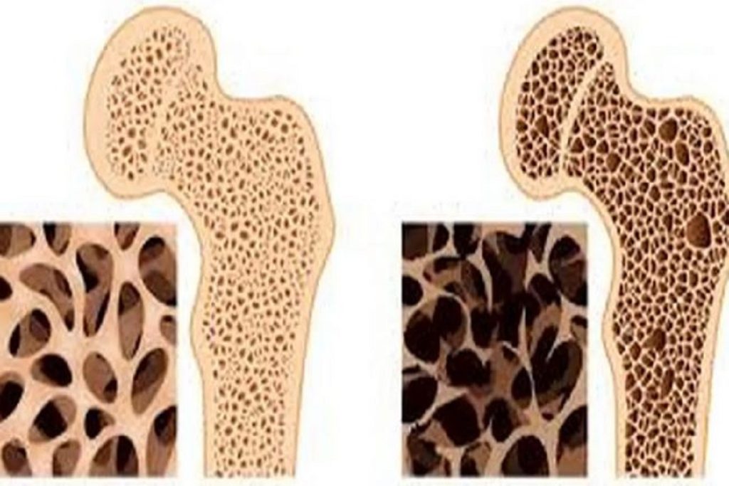داروی گیاهی
